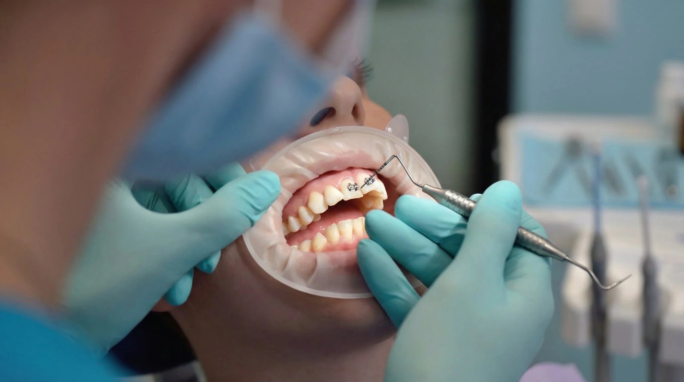 What your dentist doesn't tell you during your appointment (But Is Thinking Very Hard)