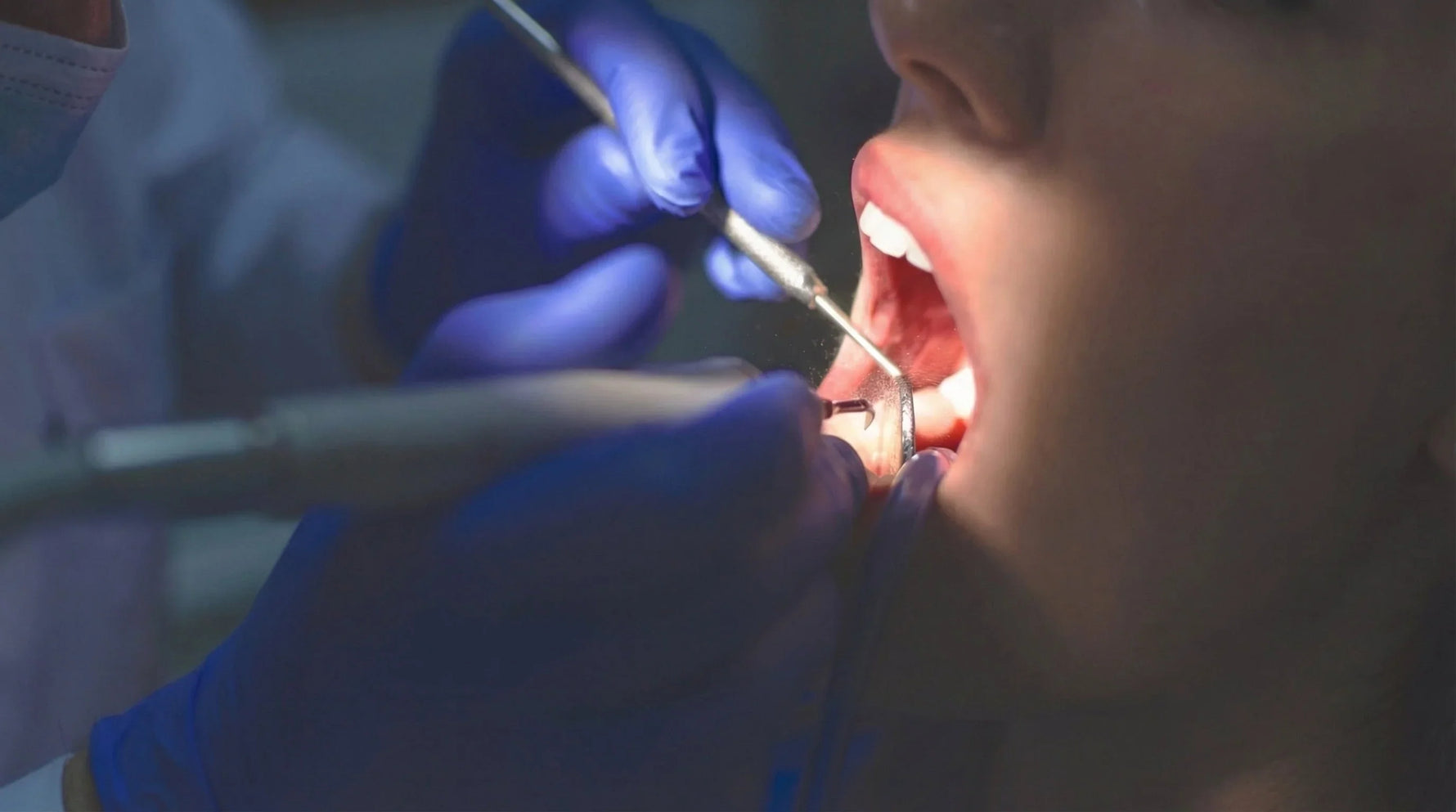 What your dental hygienist sees that you don't